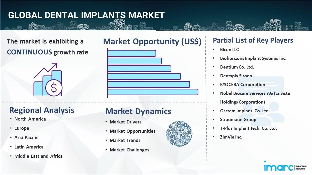 Dental Implants Market