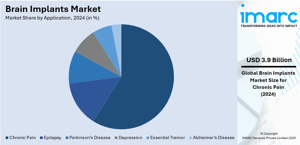 Brain Implants Market By Applicatin