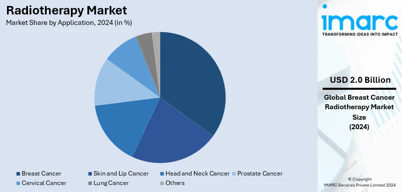 Radiotherapy Market By Application